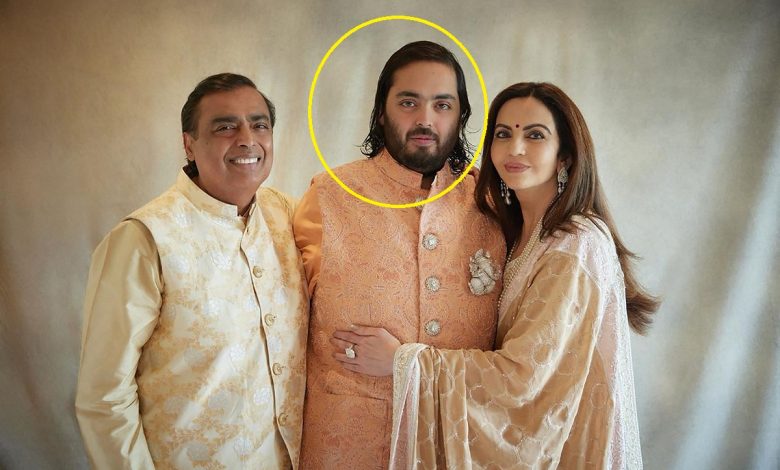 Anant Ambani's disease