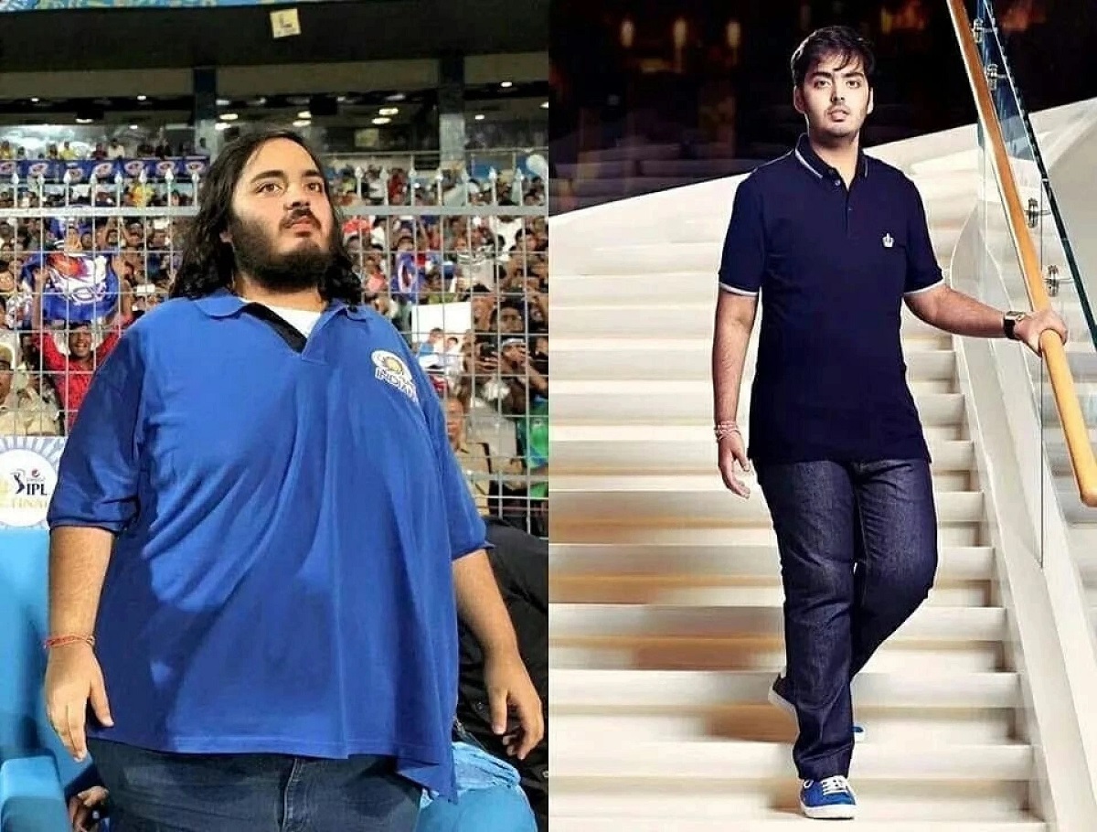 Anant Ambani's disease1