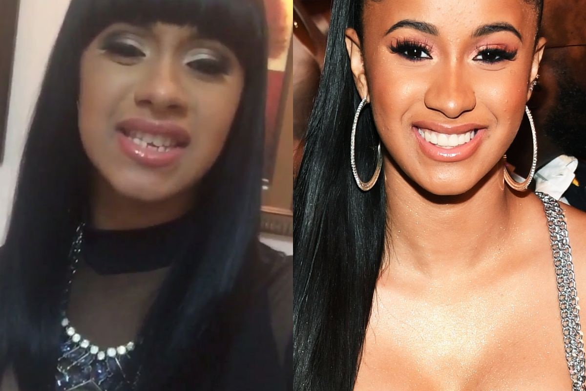 Cardi B's smile before fixed2