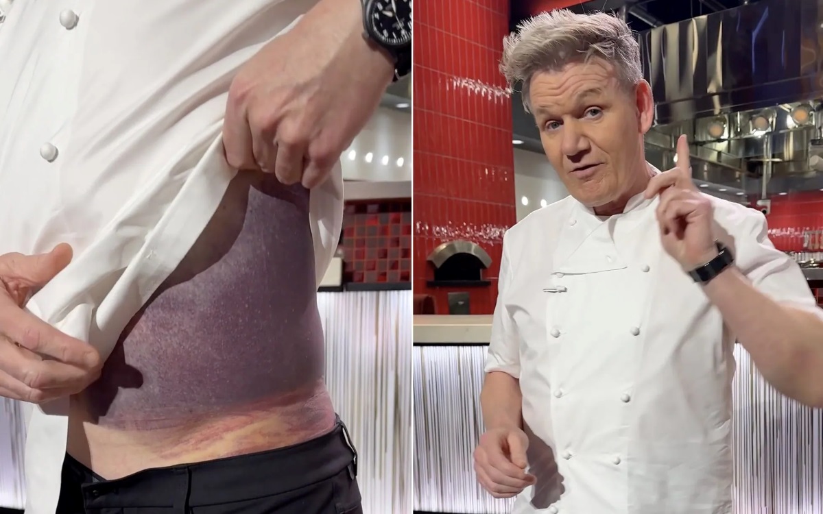 Gordon Ramsay's accident1