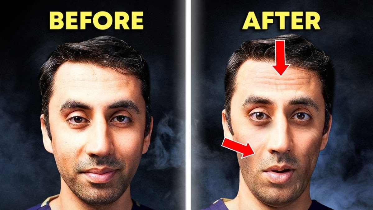 Ozempic face before and after2