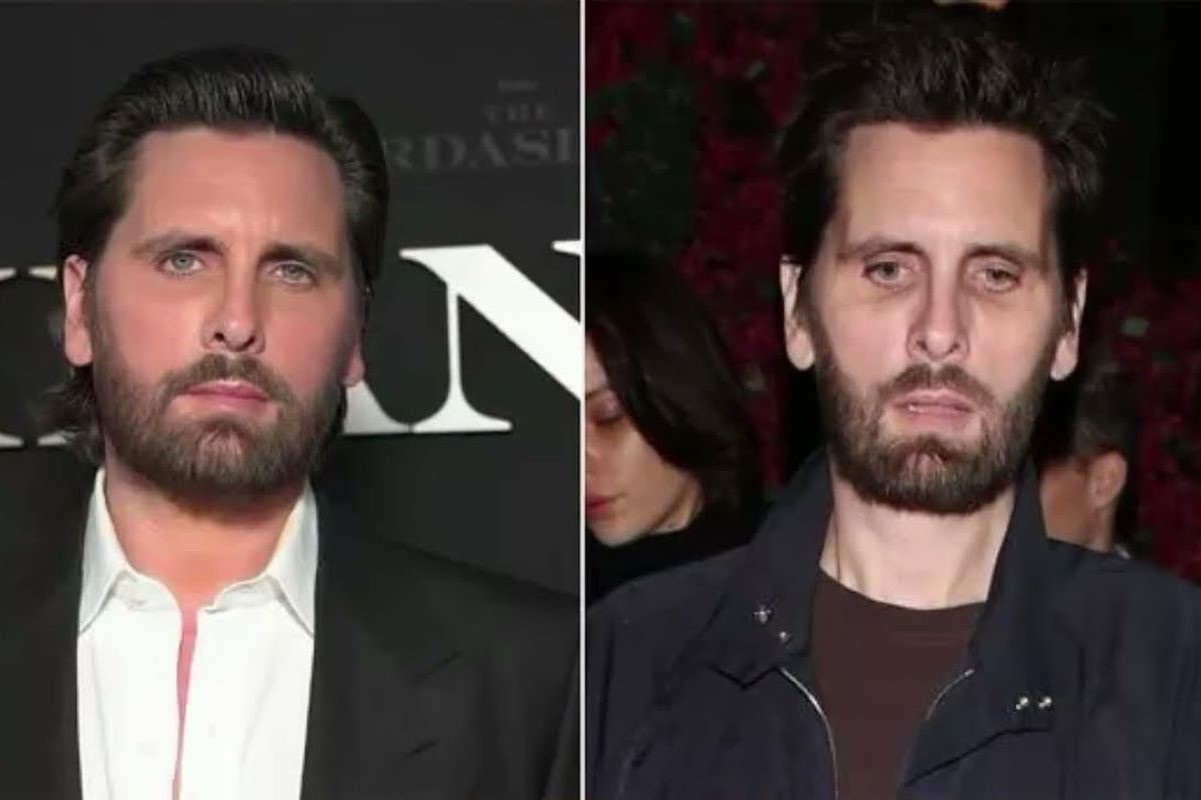 Scott Disick Ozempic face before and after