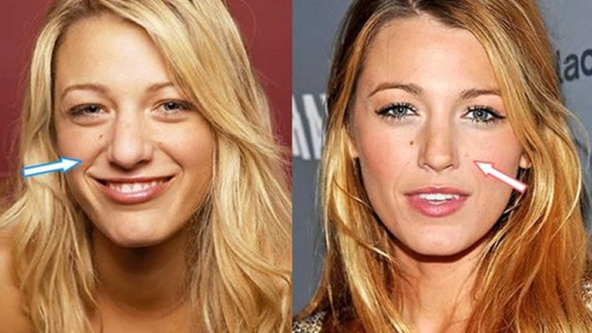 Blake Lively before nose job1