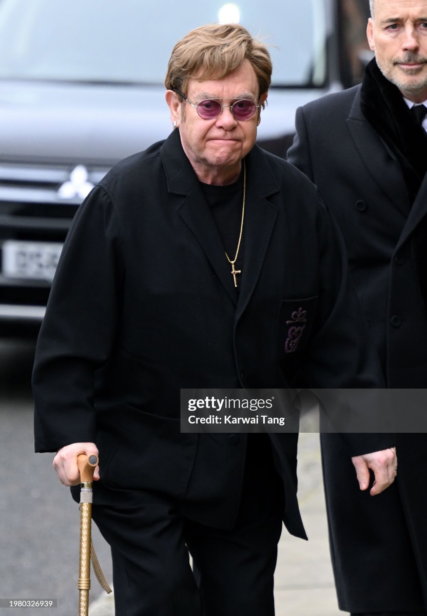 Elton John's eye infection1