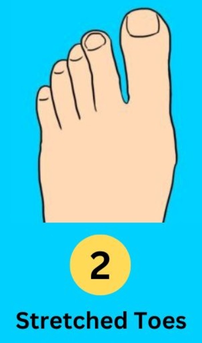 Toe Personality Test2