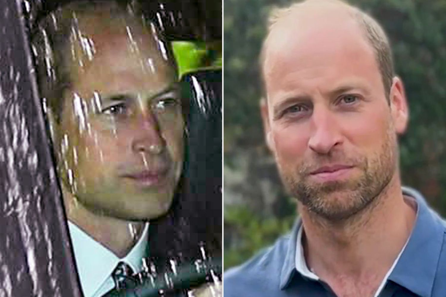 Prince William, Beard