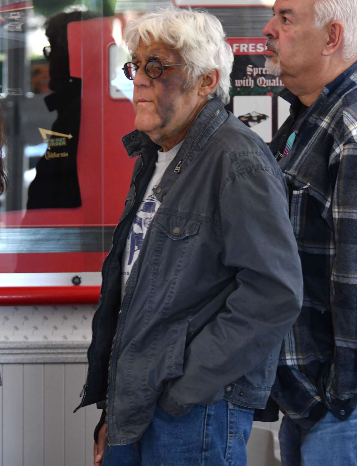 Jay Leno is seen recovering from his recent injuries as he grabs a burger and fries